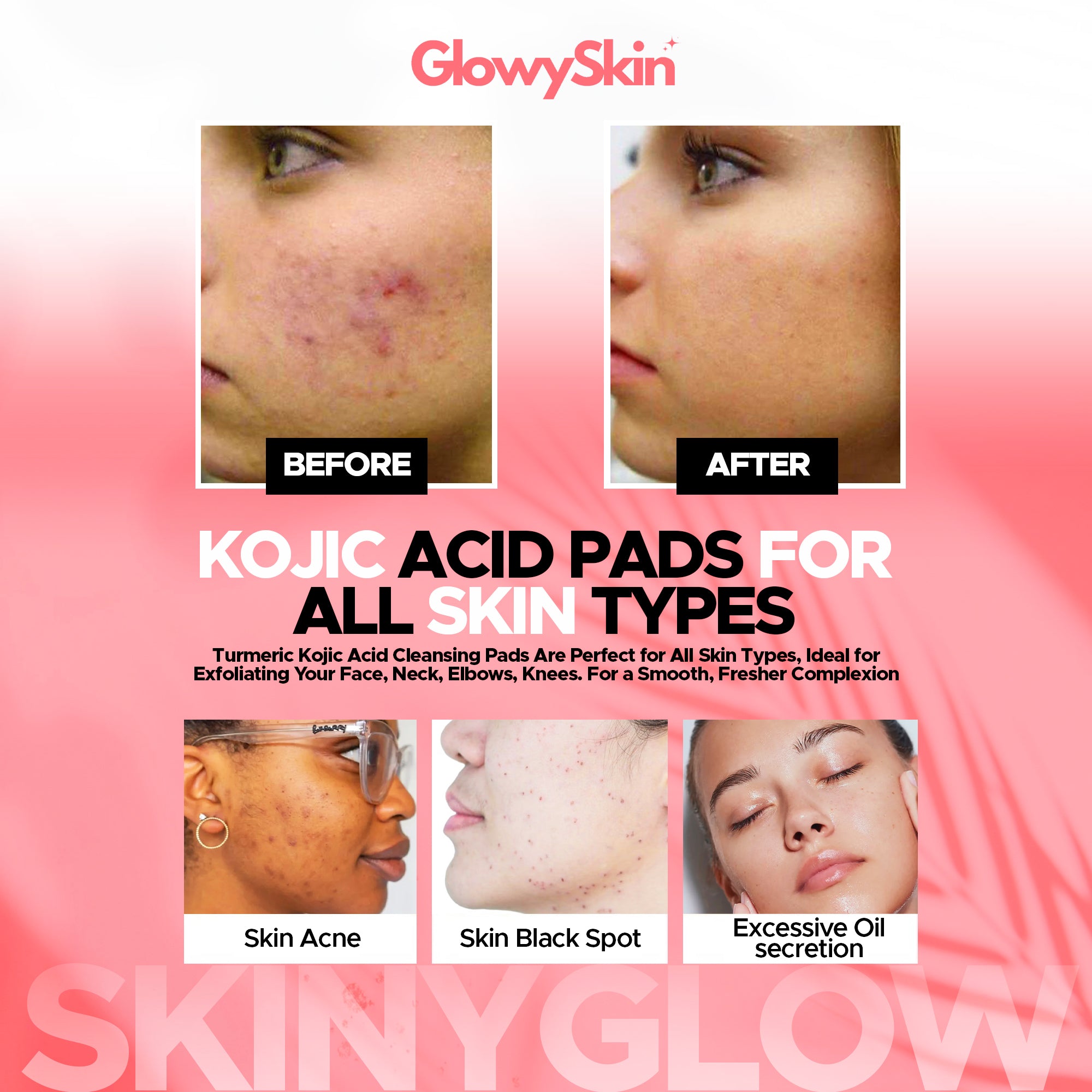 GlowySkinBalance™ Kojic Acid Pads – Brighten, Exfoliate & Fade Dark Spots Bags 40 Pieces