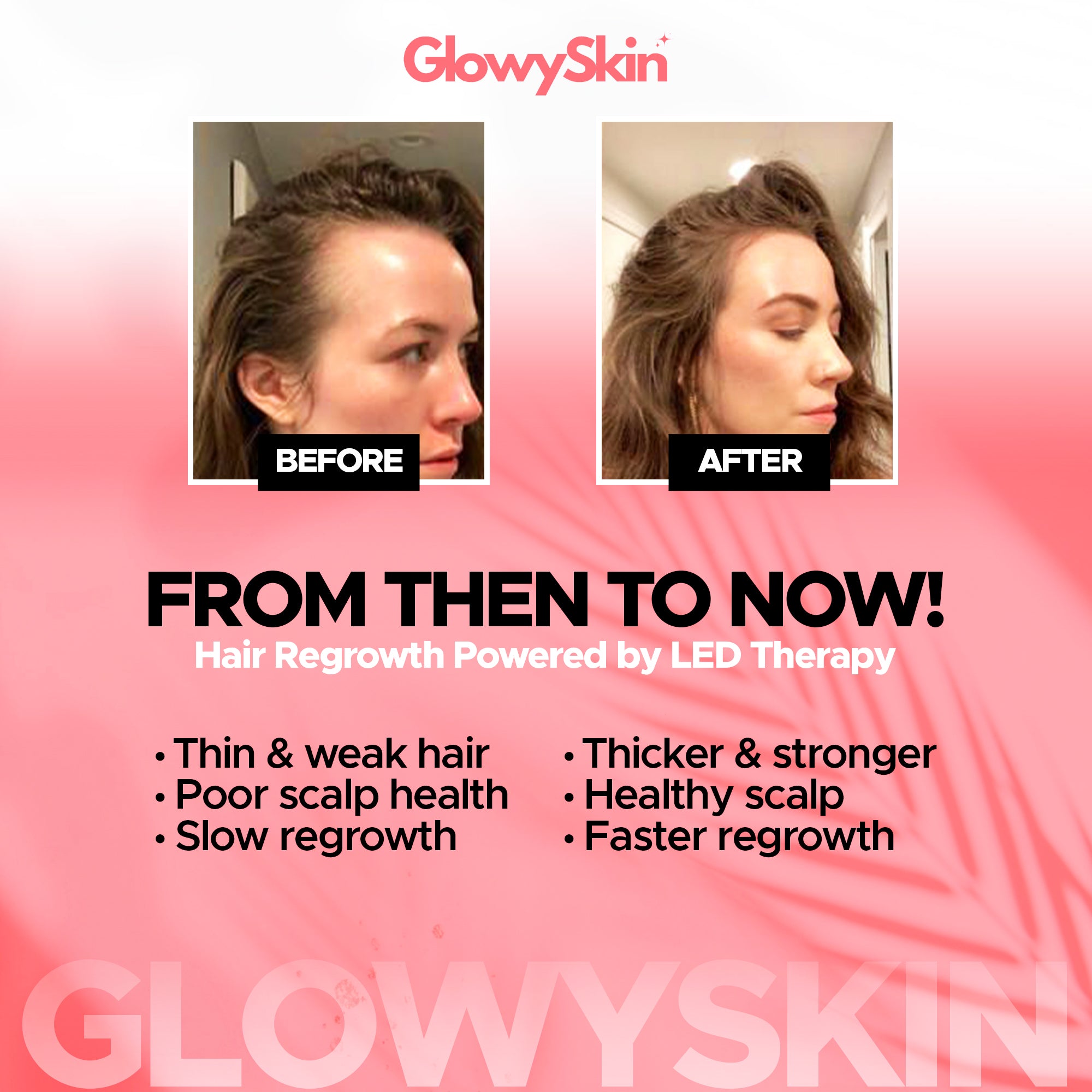 Home Red Light Therapy for Hair Growth – Advanced Light Therapy for Stronger Hair