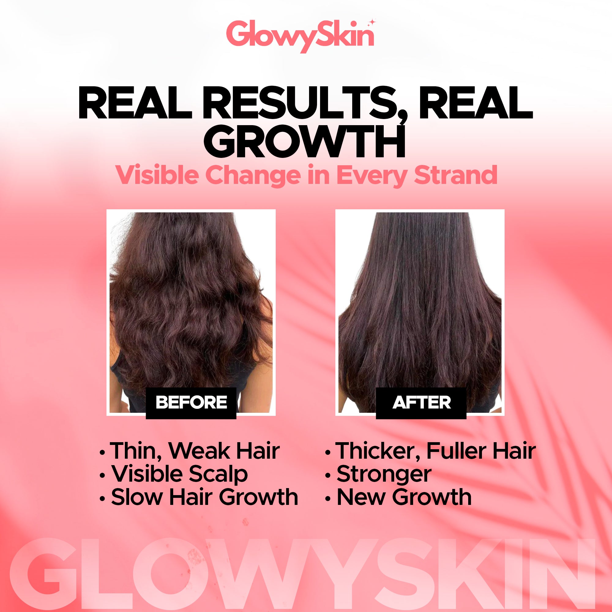 Hair Growth Micro Needle Serum Set – GlowySkin™