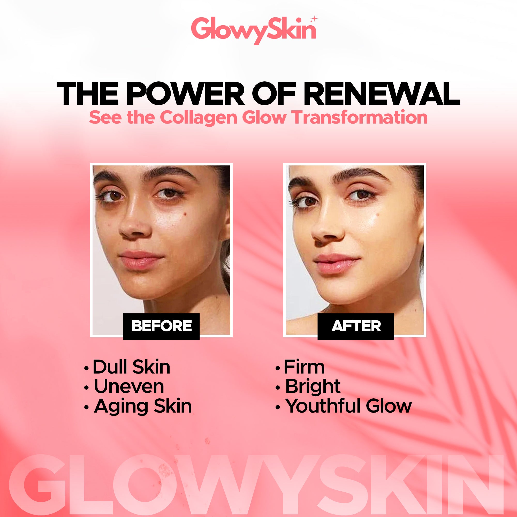 Skin Care Collagen Polypeptide Microneedle Suit - Glowyskin