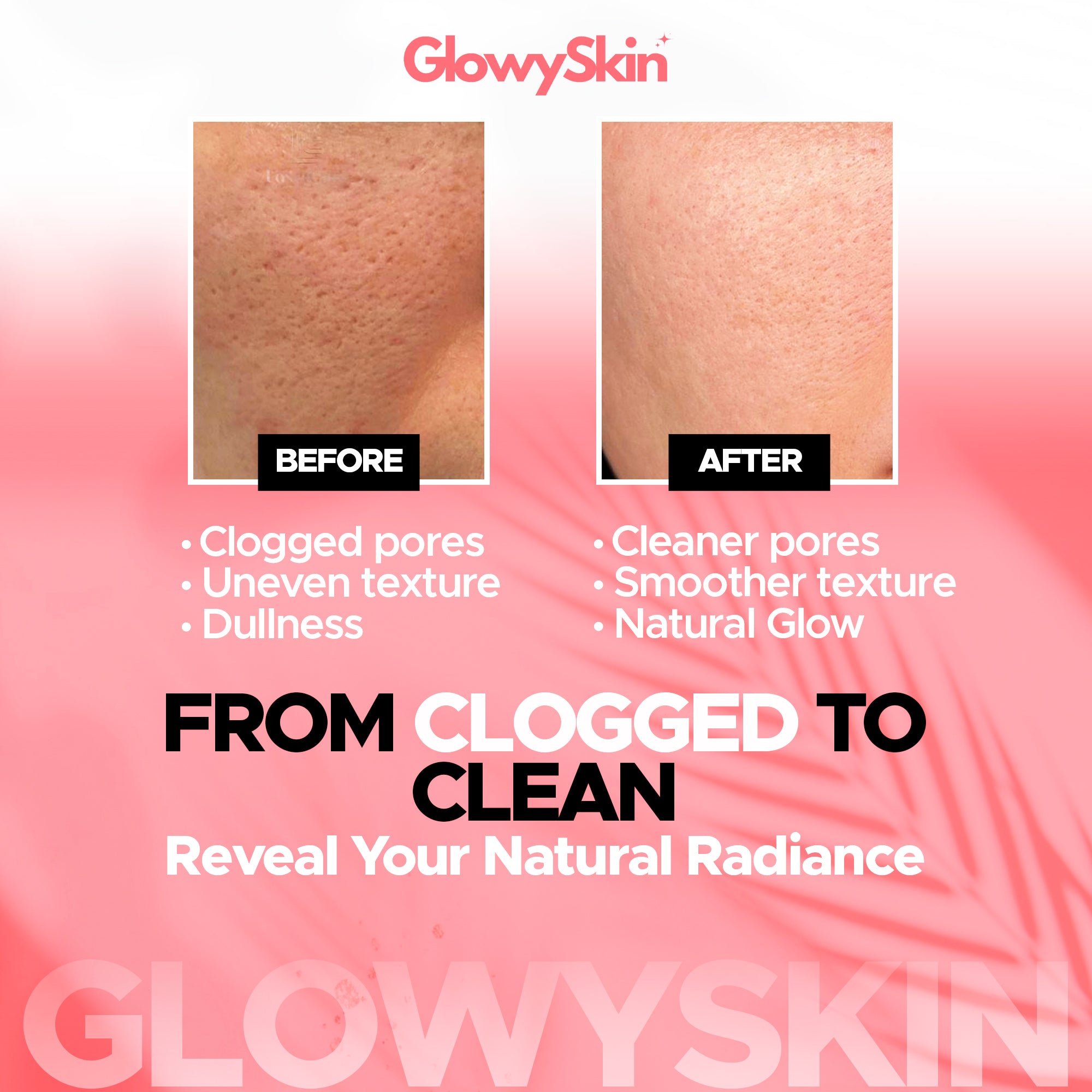 Multifunctional USB Electric Silicone Cleansing  – Deep Facial Cleansing & Skin Rejuvenation