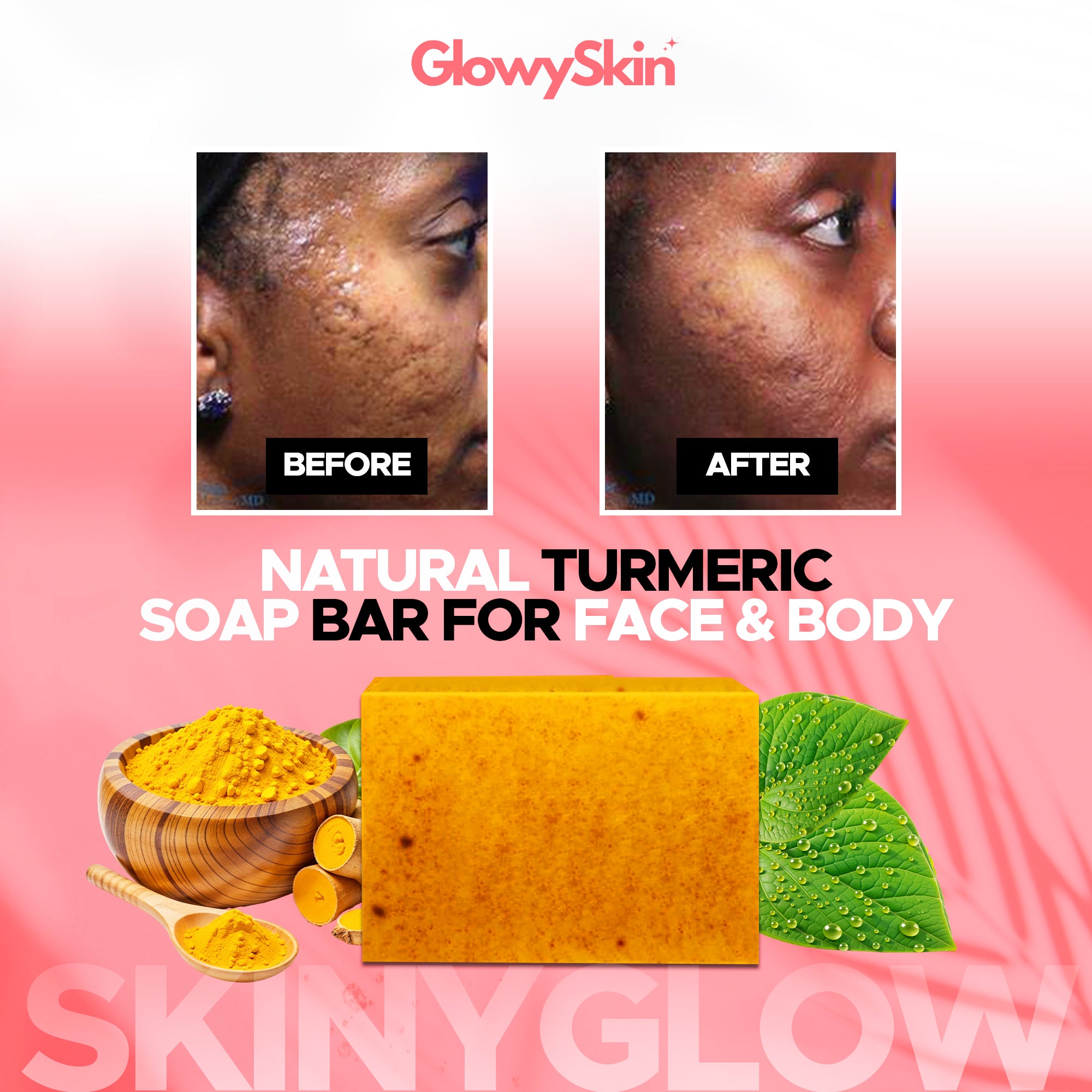 GlowyShield™ Turmeric Kojic Acid Soap – Deep Cleansing and Brightening