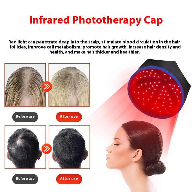 LED Hair Growth Helmet – Advanced Light Therapy for Stronger Hair